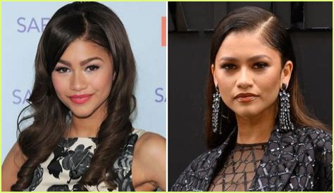 Unveiling The Truth: Zendaya's Plastic Surgery Journey
